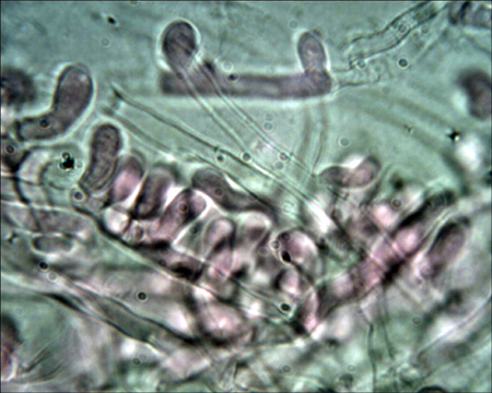 Trechispora mollusca ? (Trechispora mollusca)